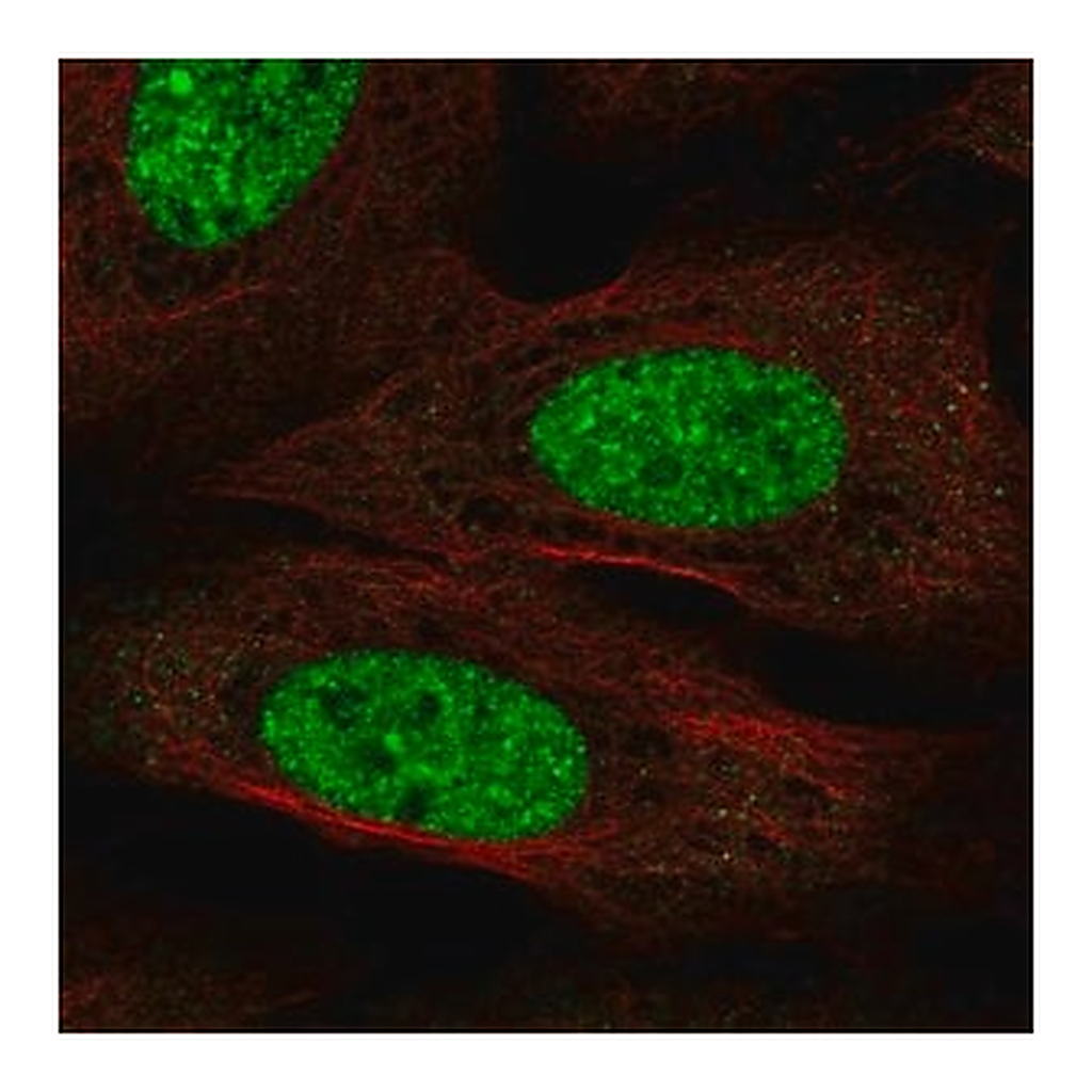 Merck Anti-CPEB3 antibody produced in rabbit