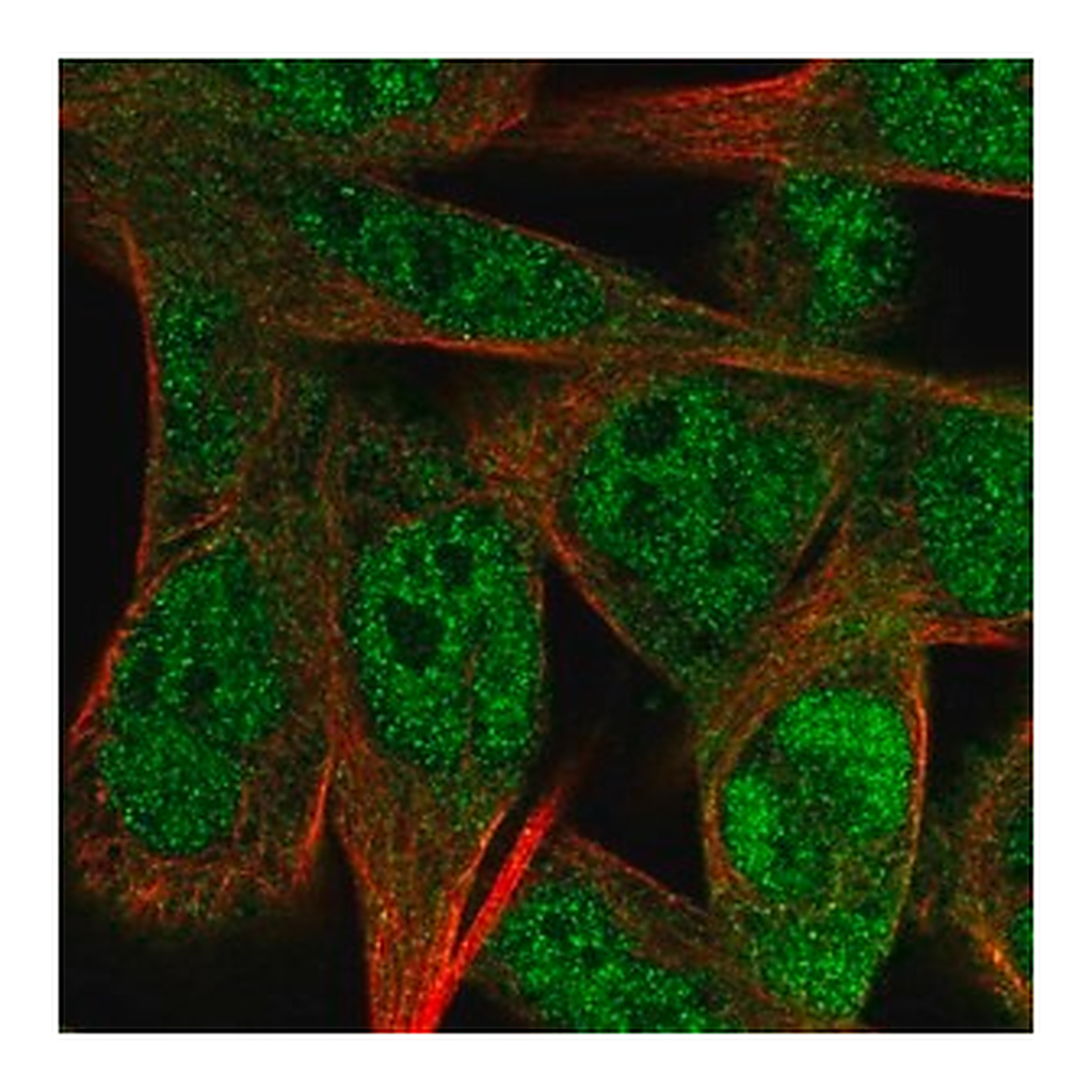 Merck Anti-SS18L1 antibody produced in rabbit