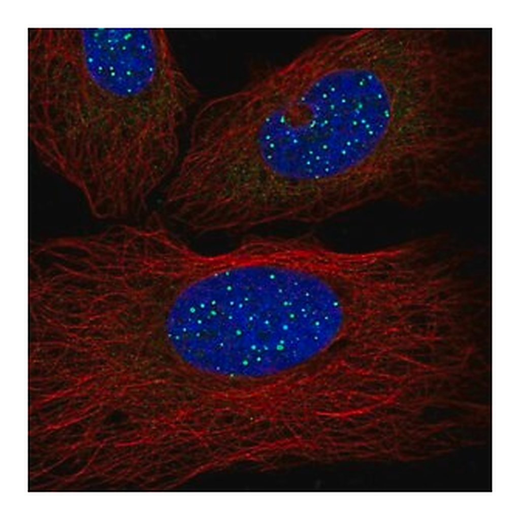 Merck Anti-TINF2 antibody produced in rabbit