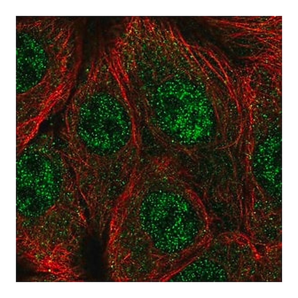 Merck Anti-CPSF1 antibody produced in rabbit