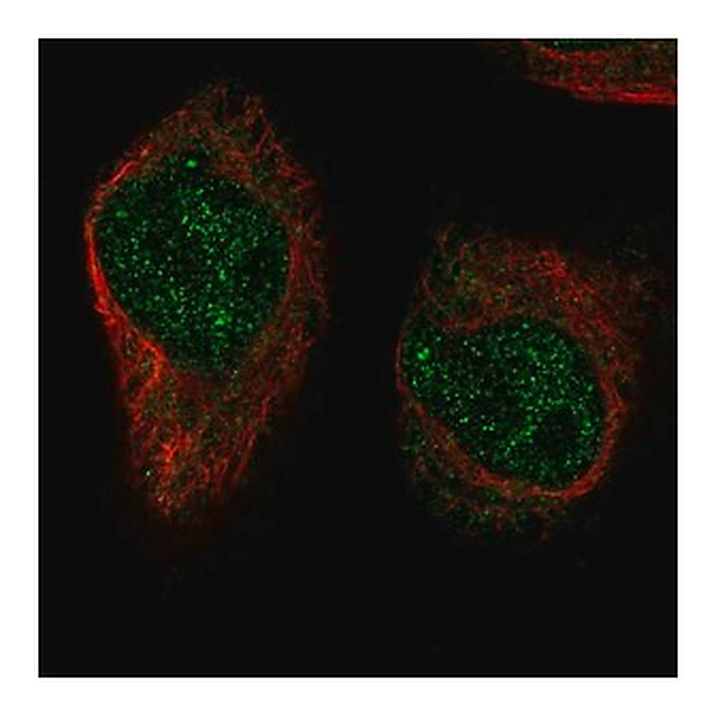 Merck Anti-XRCC3 antibody produced in rabbit