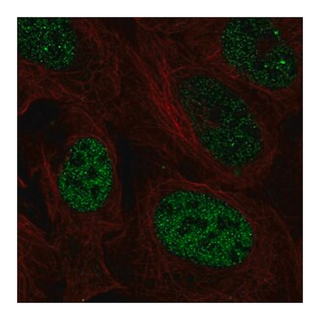 Merck Anti-PAX3 antibody produced in rabbit