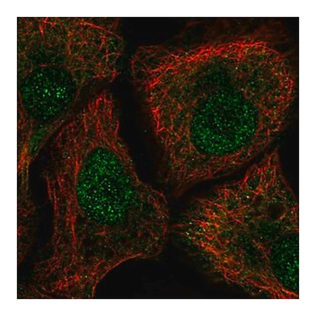 Merck Anti-TUT1 antibody produced in rabbit