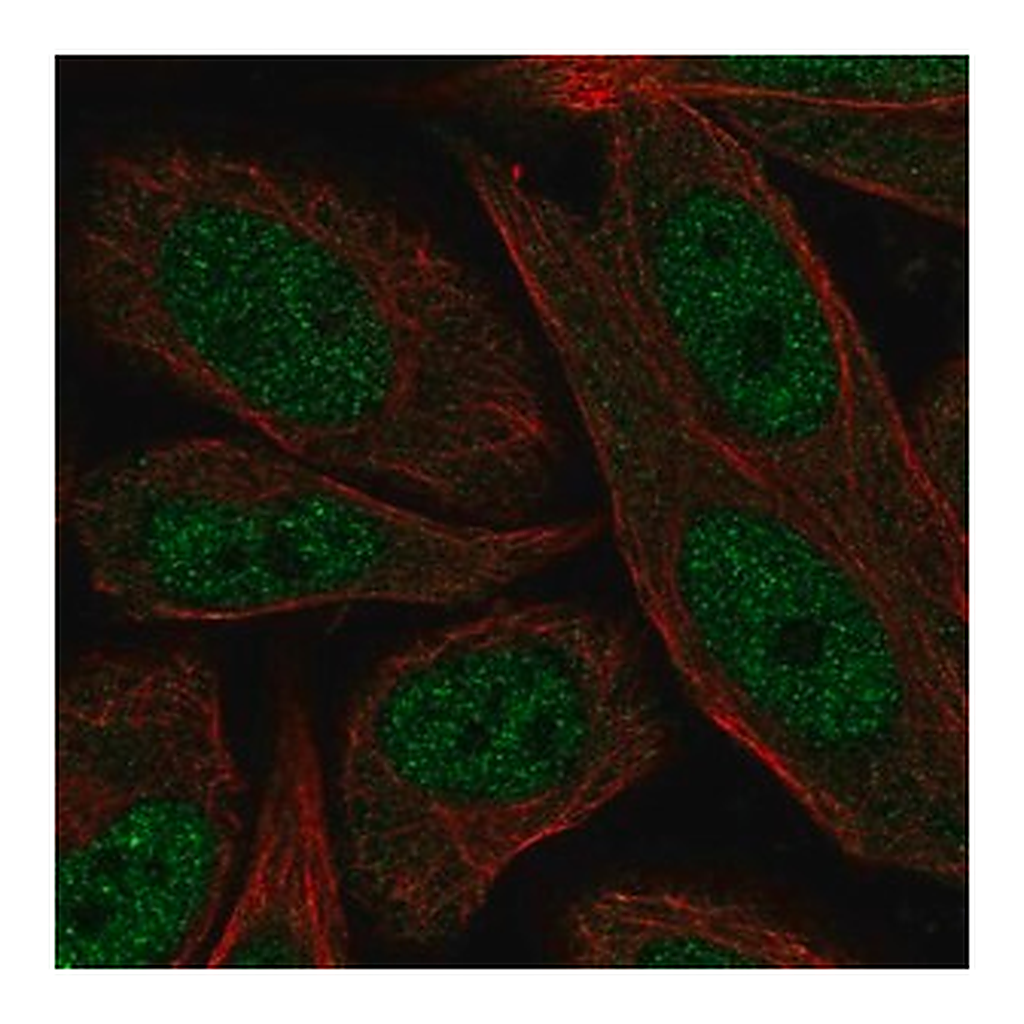 Merck Anti-ERCC2 antibody produced in rabbit