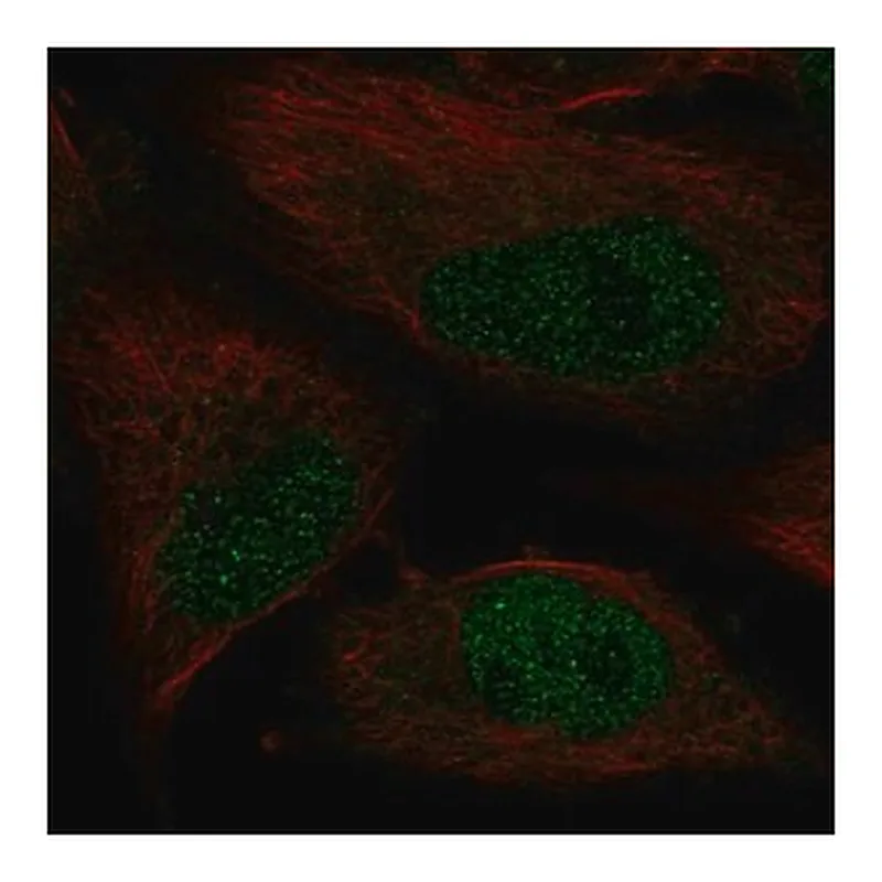 Merck Anti-POLK antibody produced in rabbit