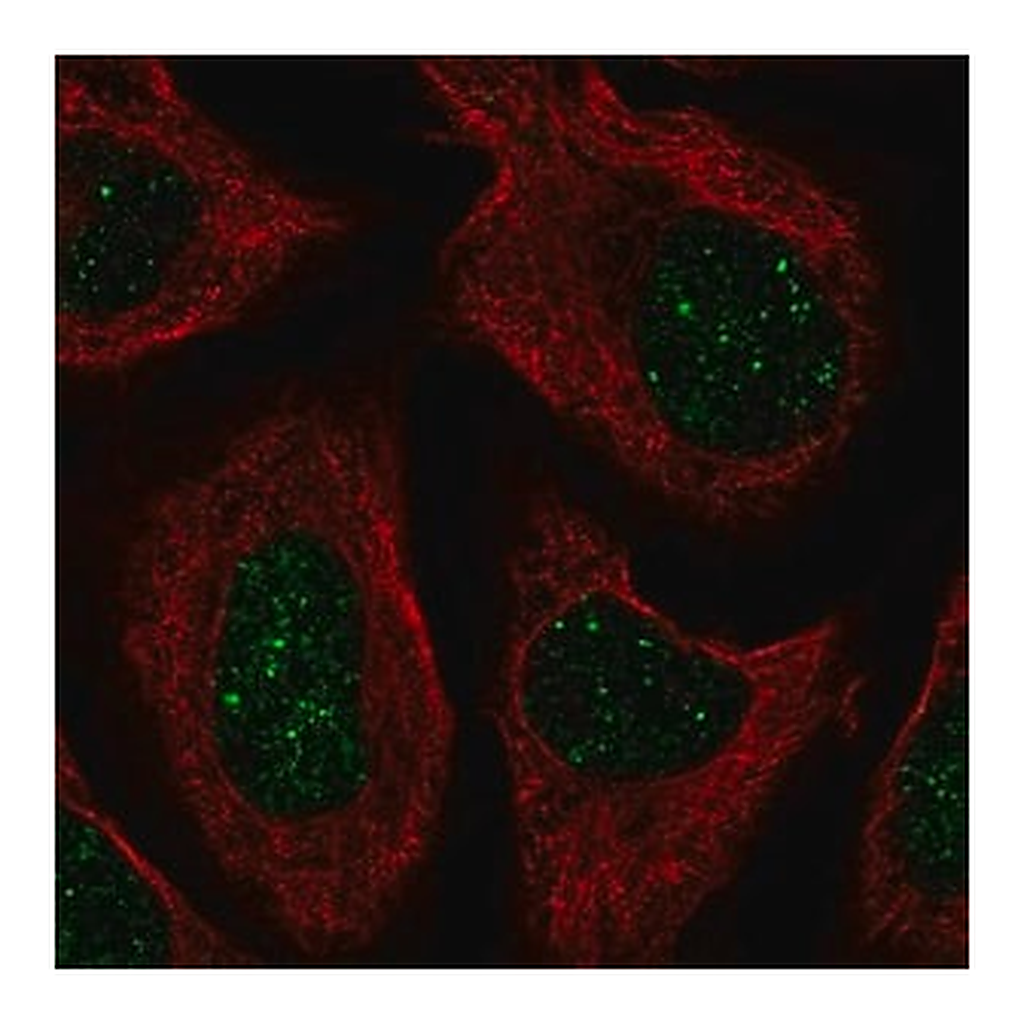 Merck Anti-CNOT7 antibody produced in rabbit