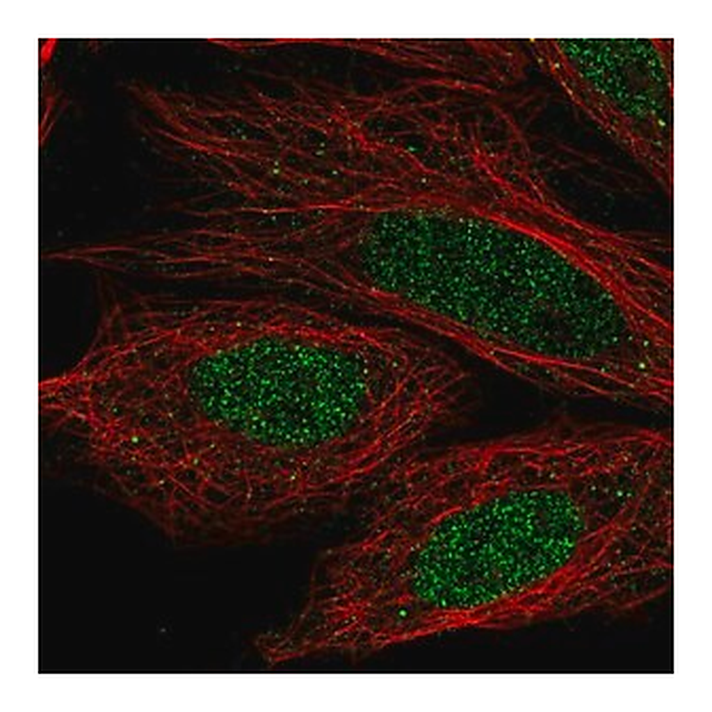 Merck Anti-CCDC36 antibody produced in rabbit