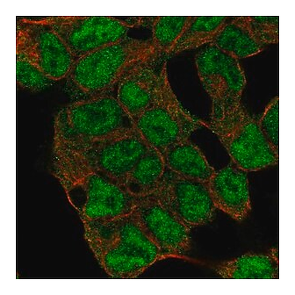 Merck Anti-KDM5C antibody produced in rabbit