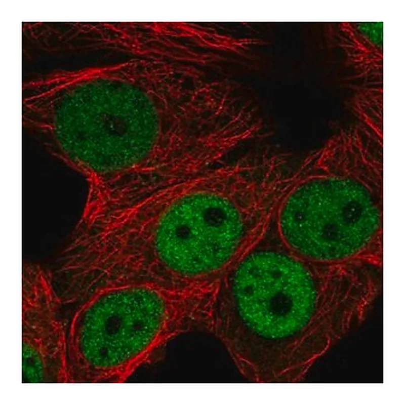 Merck Anti-RNF168 antibody produced in rabbit