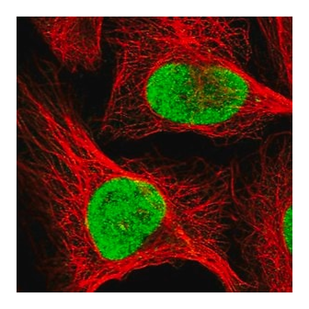 Merck Anti-RFC1 antibody produced in rabbit