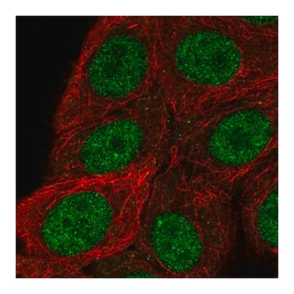 Merck Anti-RSF1 antibody produced in rabbit