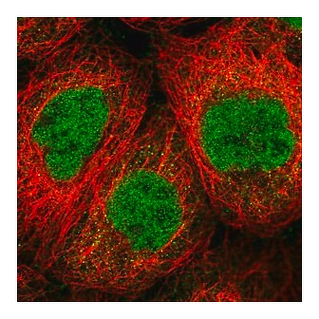 Merck Anti-SENP1 antibody produced in rabbit
