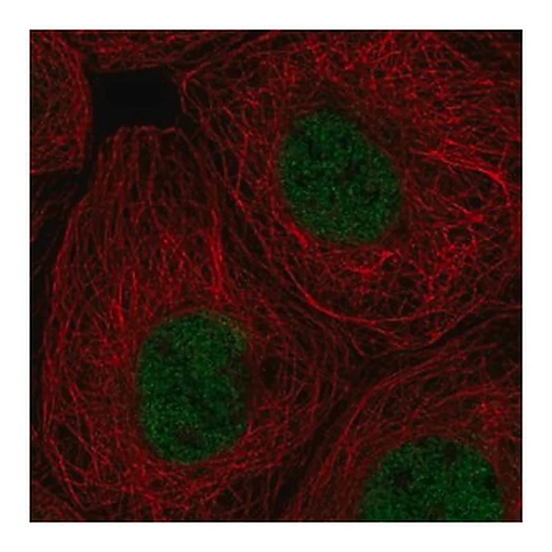 Merck Anti-RPA1 antibody produced in rabbit
