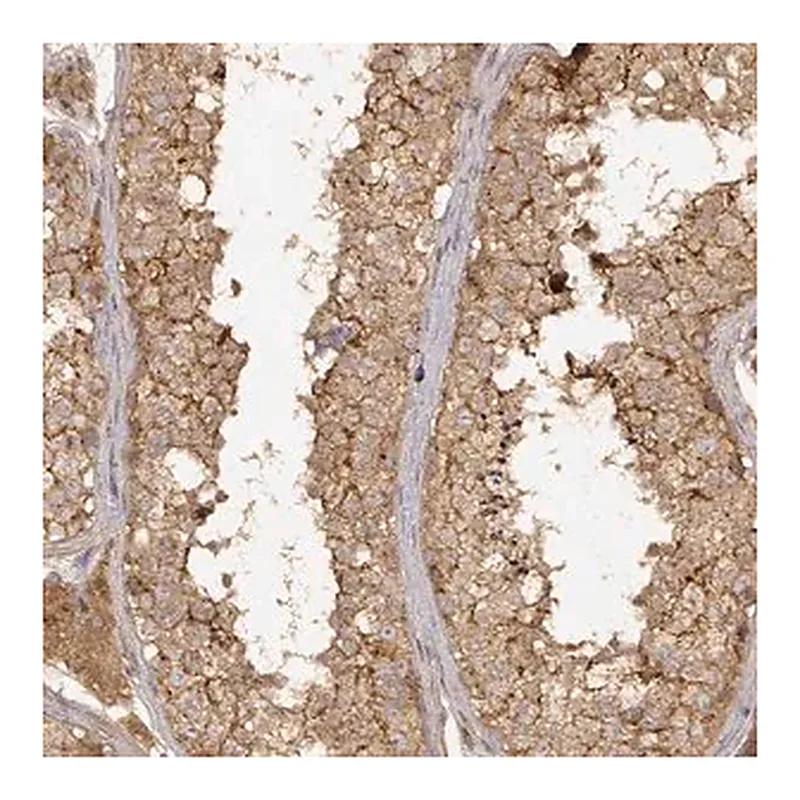Merck Anti-CDK5RAP2 antibody produced in rabbit