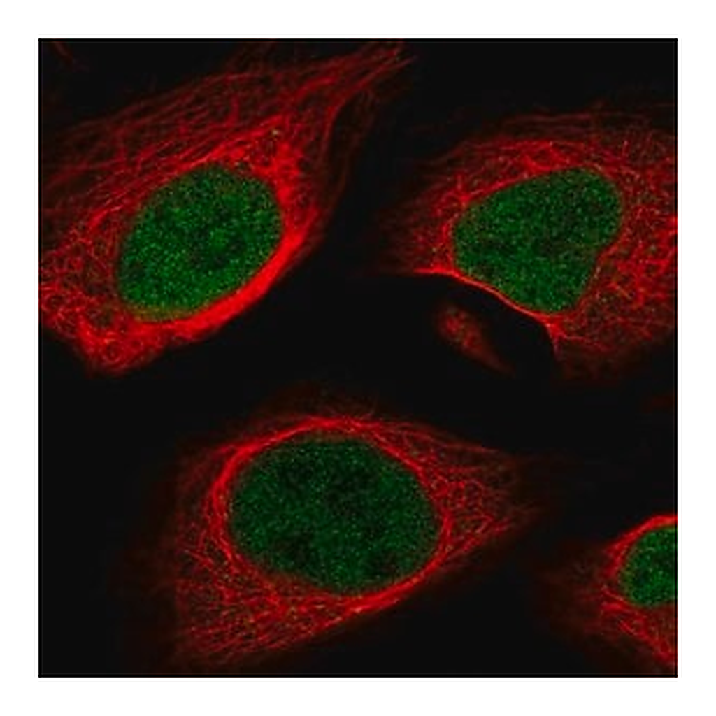 Merck Anti-MEF2A antibody produced in rabbit