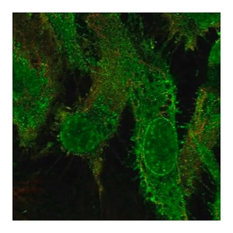 Merck Anti-GRK5 antibody produced in rabbit