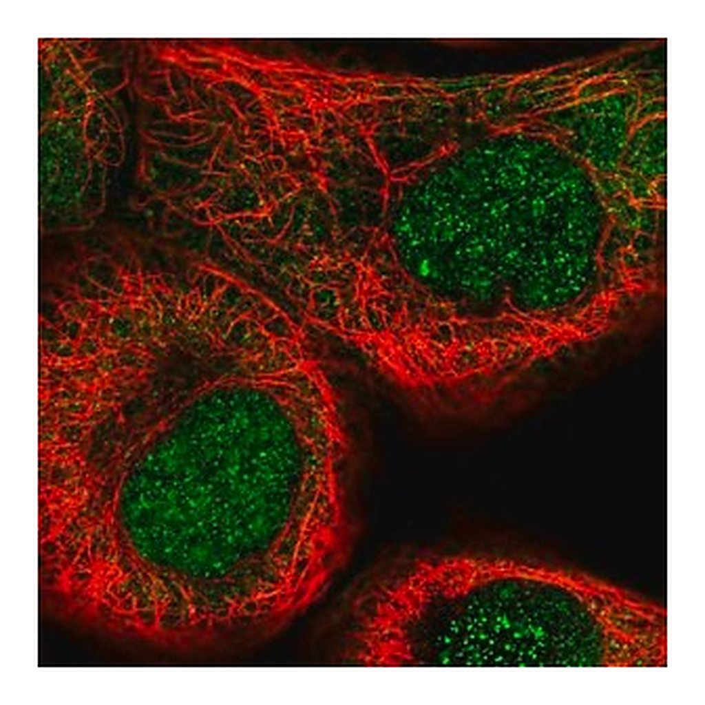 Merck Anti-NSUN5 antibody produced in rabbit