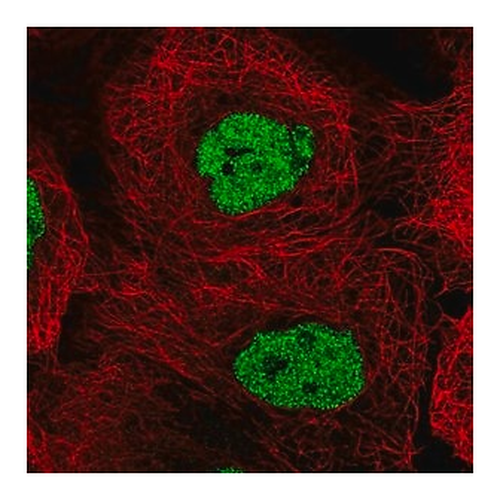 Merck Anti-CSNK2A1 antibody produced in rabbit