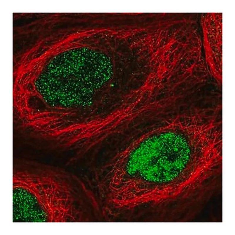 Merck Anti-N6AMT1 antibody produced in rabbit