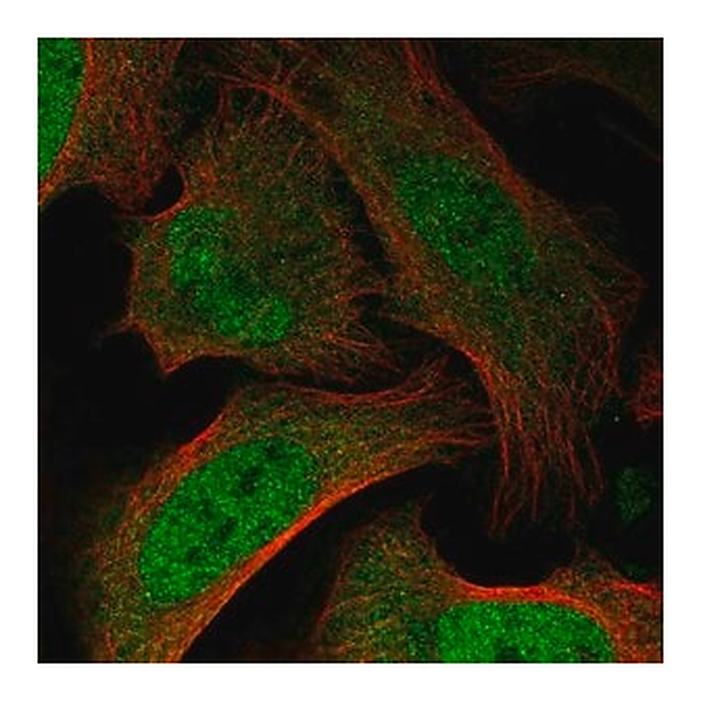 Merck Anti-BAZ2B antibody produced in rabbit