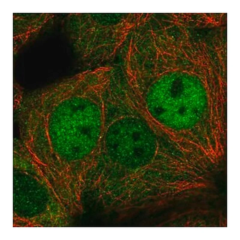 Merck Anti-DIP2C antibody produced in rabbit