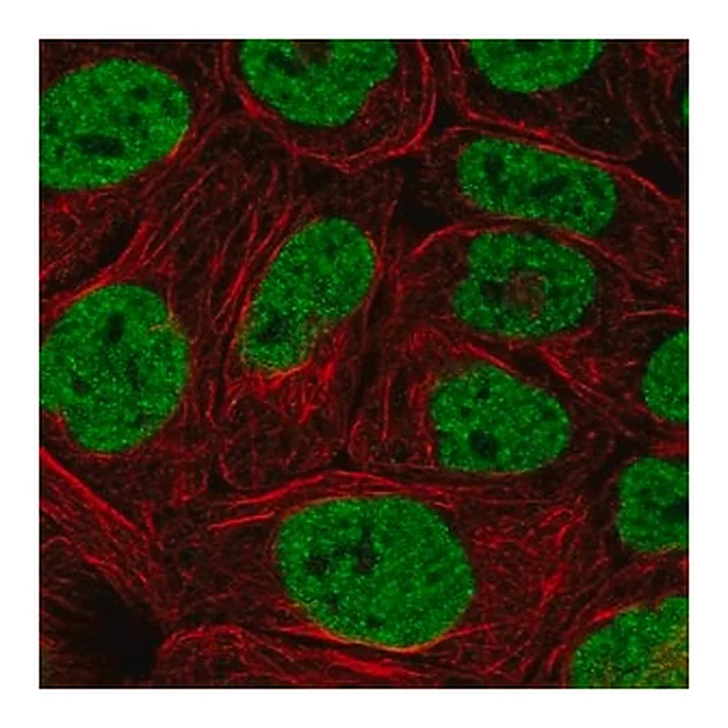 Merck Anti-PBRM1 antibody produced in rabbit