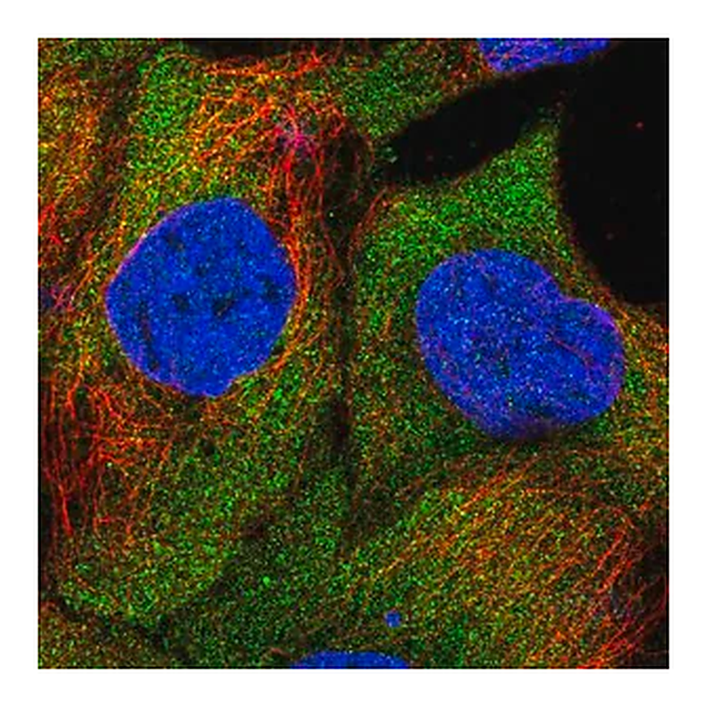 Merck Anti-SAMD4B antibody produced in rabbit