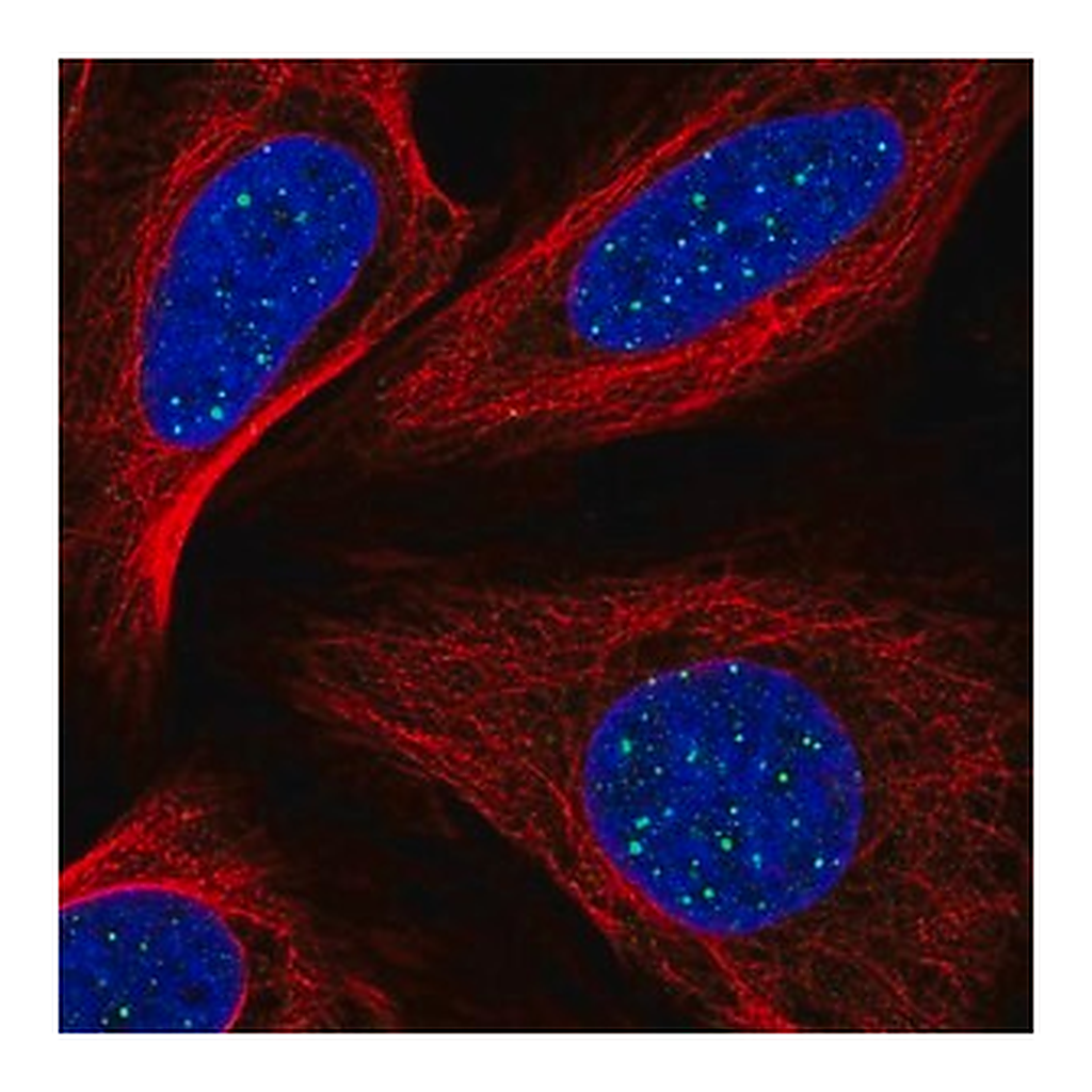 Merck Anti-TINF2 antibody produced in rabbit