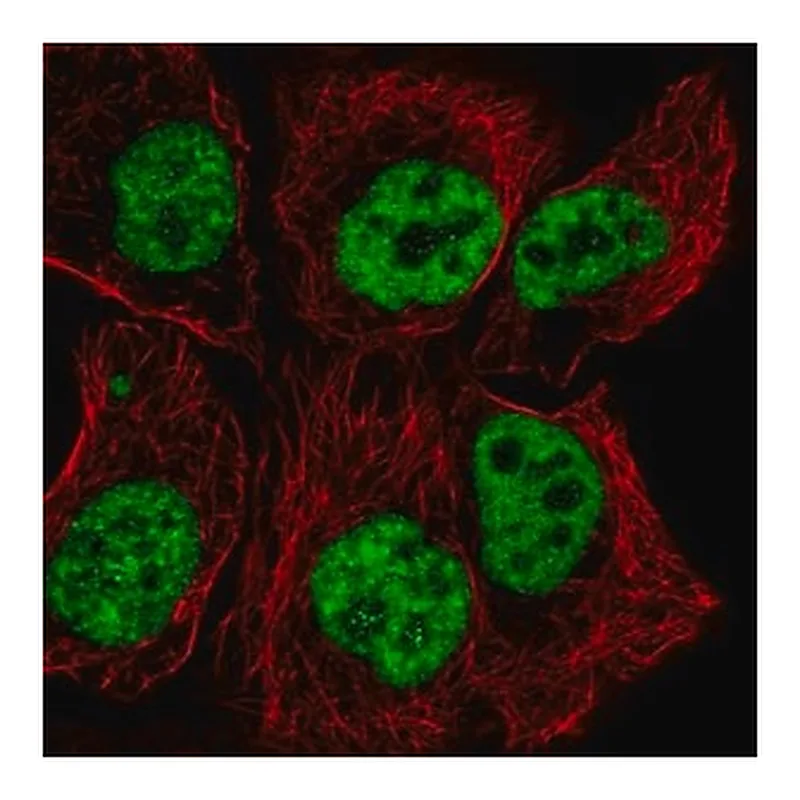 Merck Anti-TCERG1 antibody produced in rabbit
