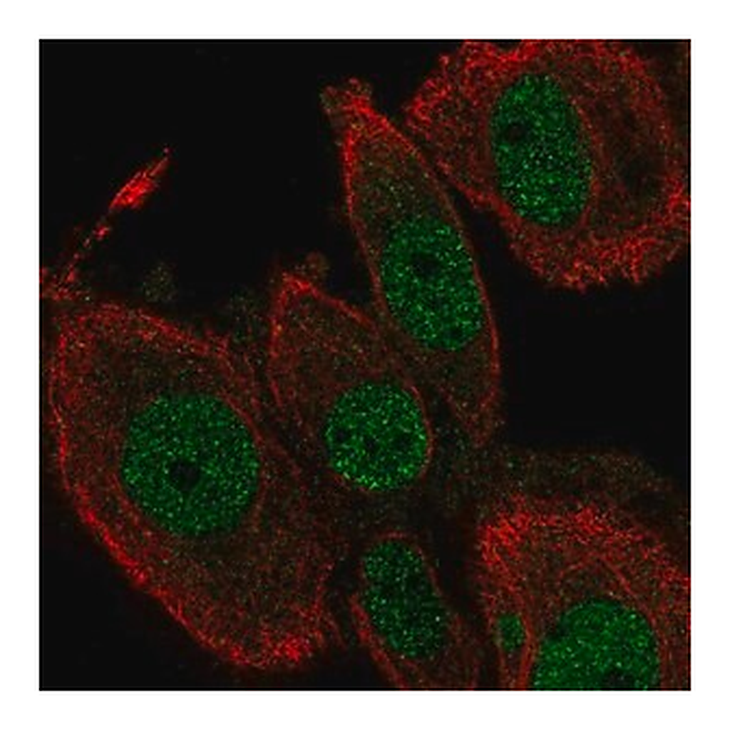 Merck Anti-TEAD2 antibody produced in rabbit