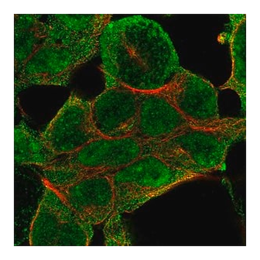 Merck Anti-NSD1 antibody produced in rabbit