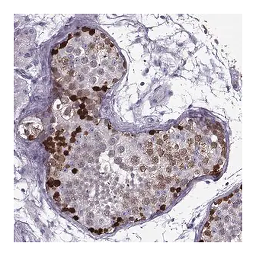 Merck Anti-GAGE1 antibody produced in rabbit