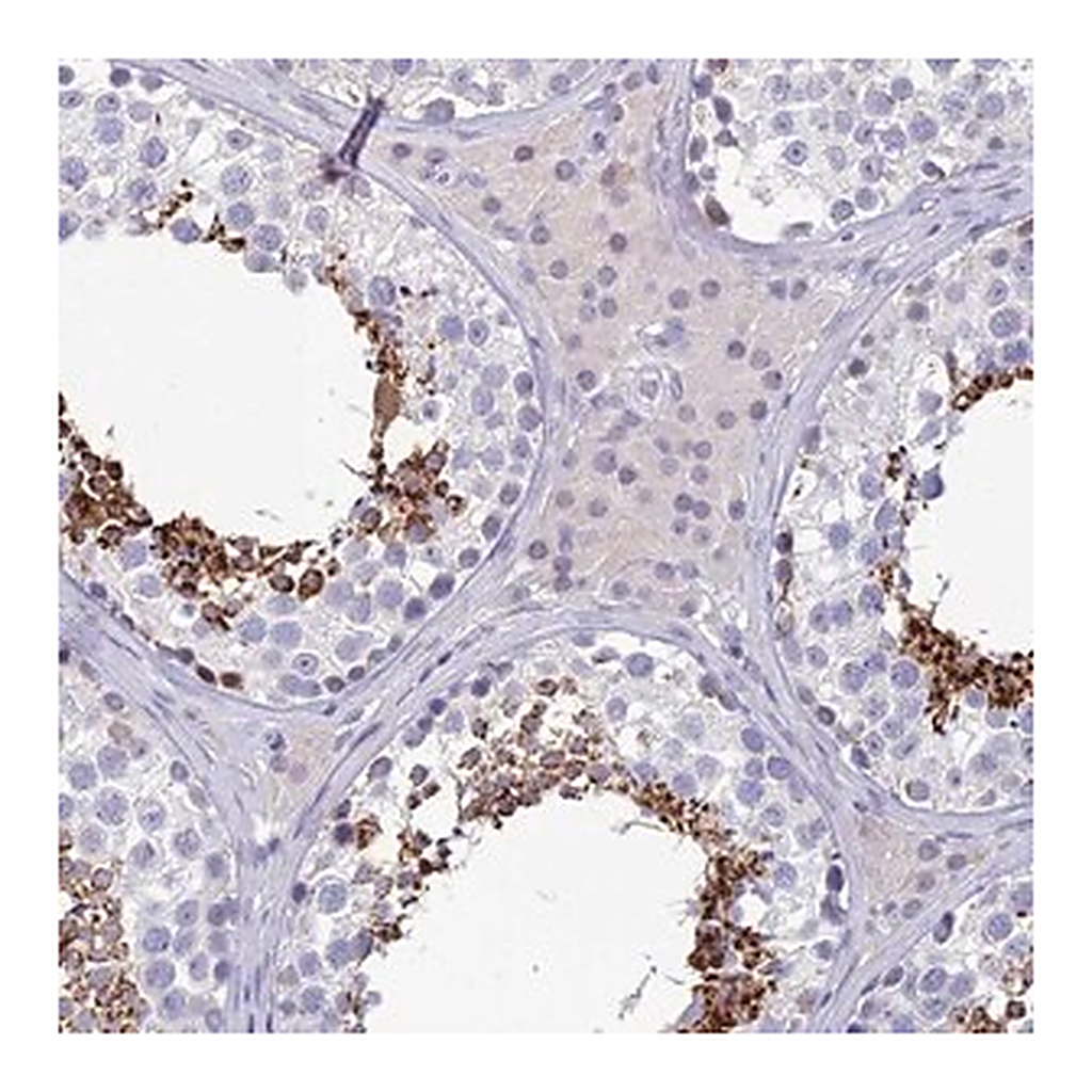 Merck Anti-GOLGA6A antibody produced in rabbit