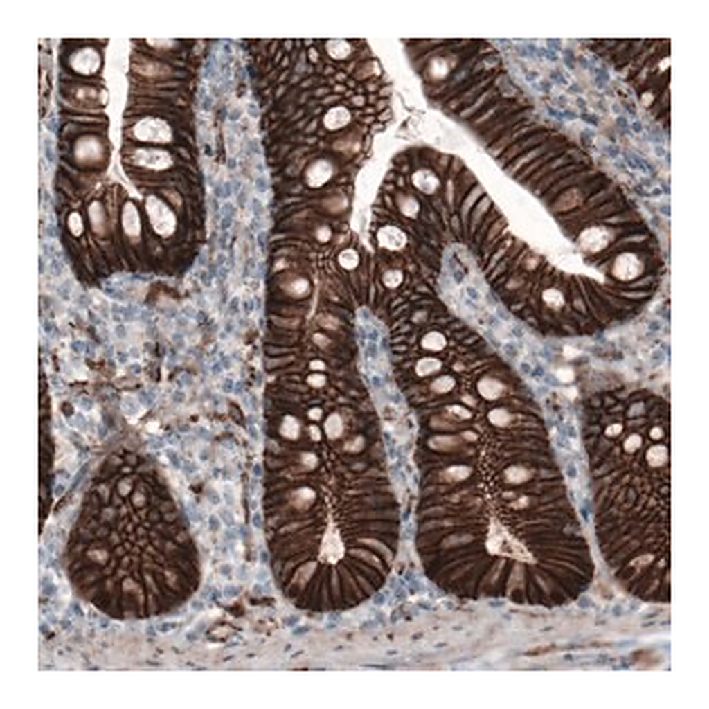 Merck Monoclonal Anti-CTNNB1 antibody produced in mouse