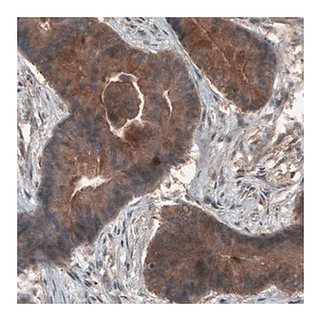 Merck Monoclonal Anti-ST13 antibody produced in mouse