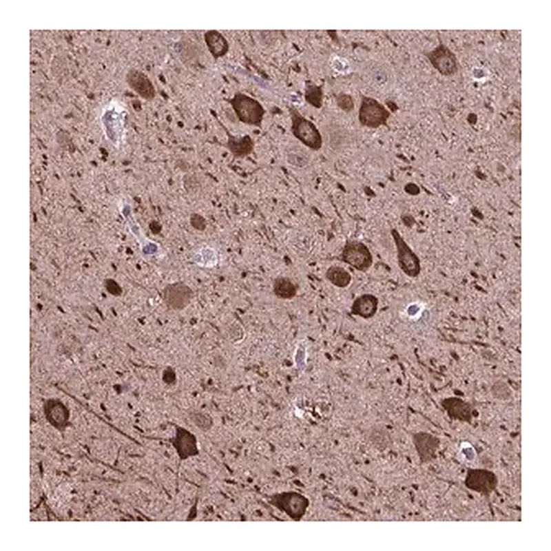 Merck Anti-PIAS3 antibody produced in rabbit