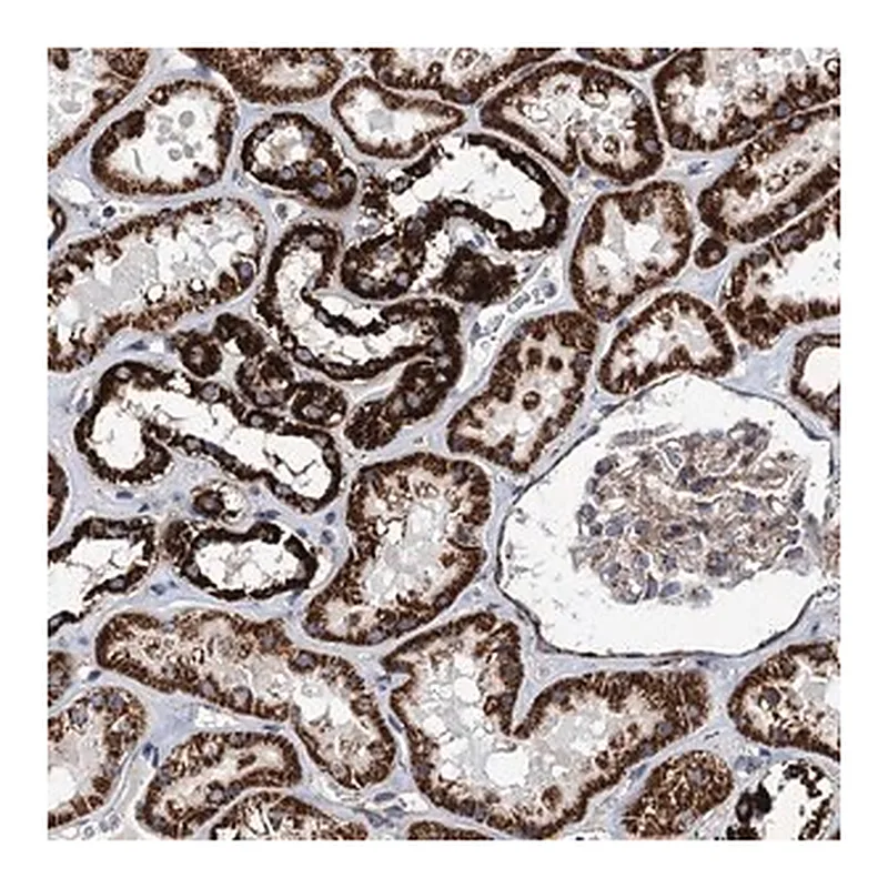 Merck Anti-TSSK3 antibody produced in rabbit