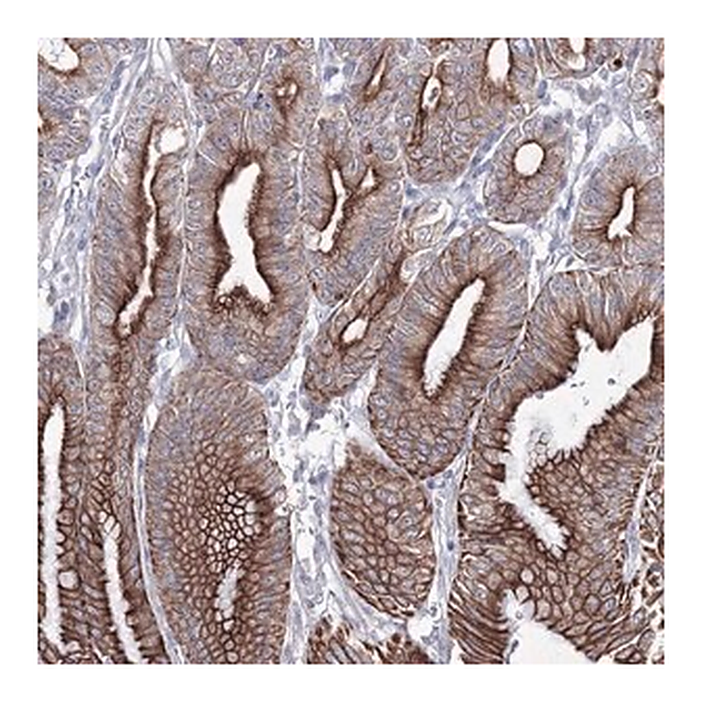 Merck Anti-C6orf1 antibody produced in rabbit