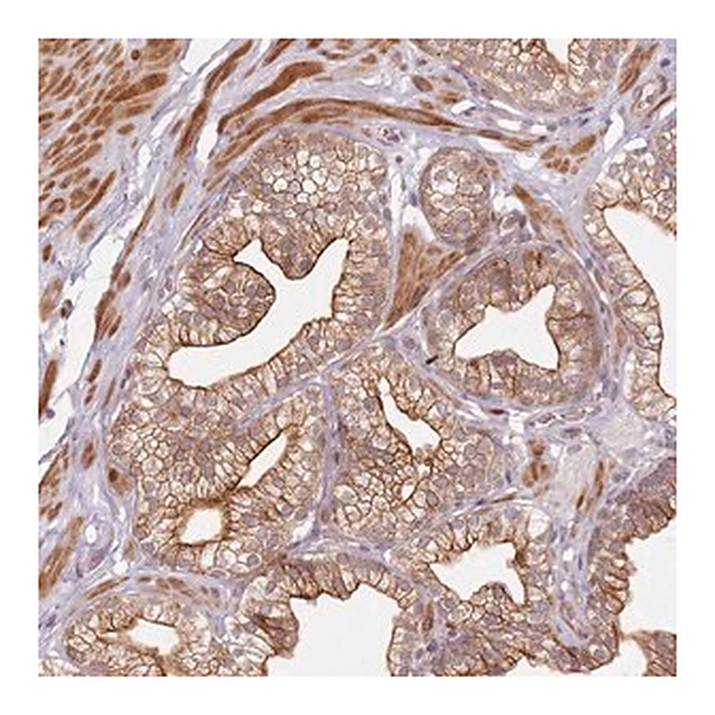 Merck Anti-RPS6KA2 antibody produced in rabbit