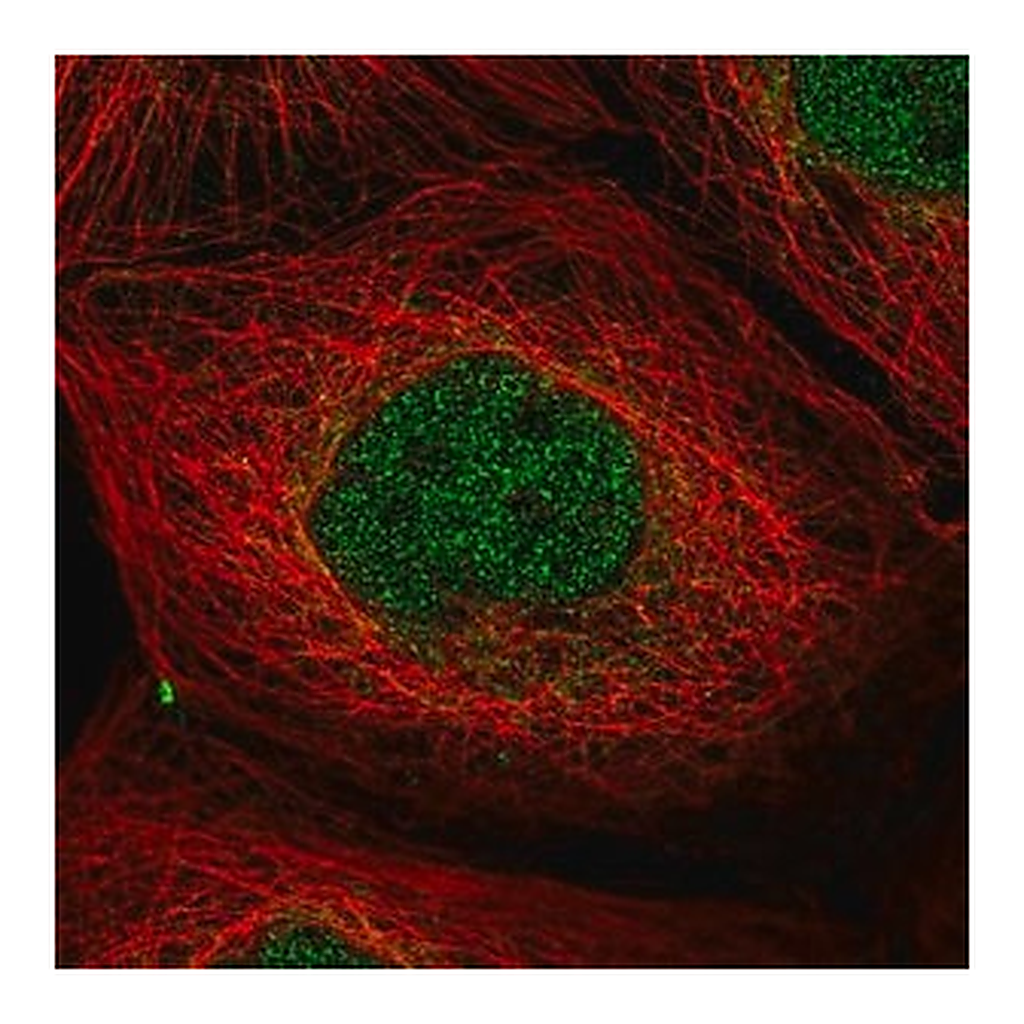 Merck Anti-PPP1R2 antibody produced in rabbit
