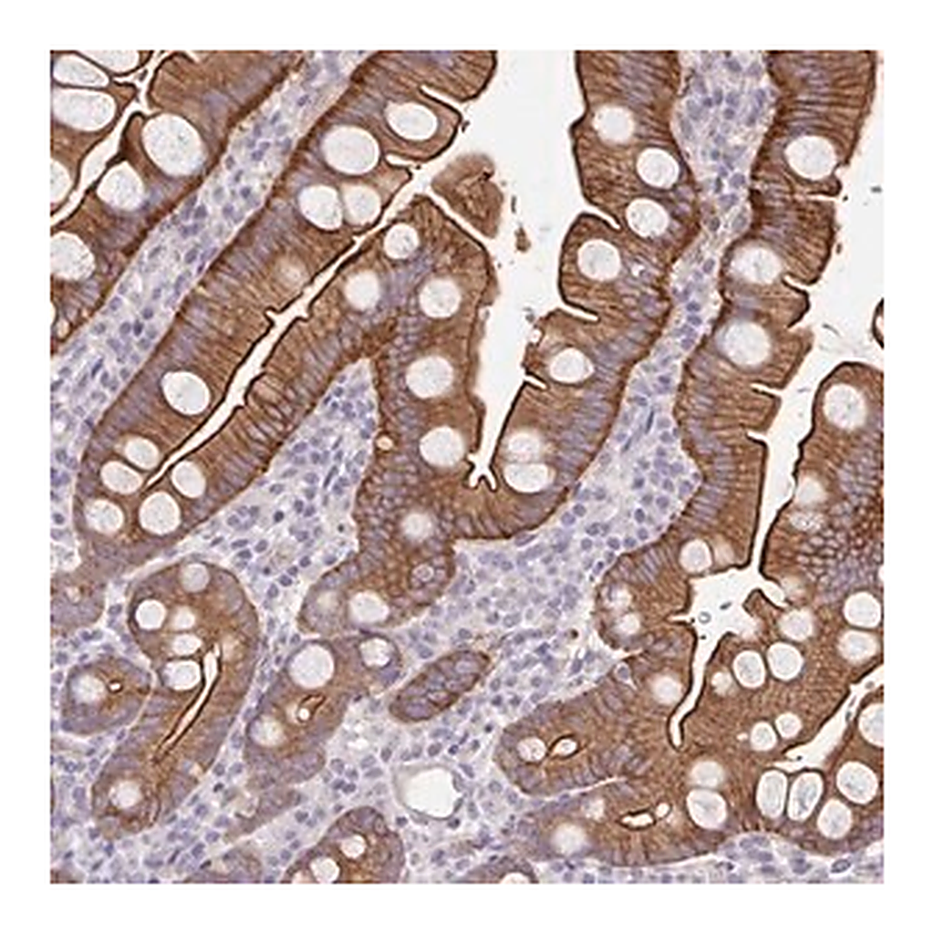 Merck Anti-PTPN3 antibody produced in rabbit