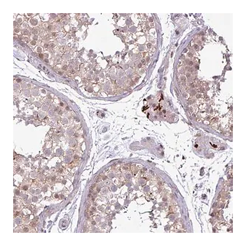 Merck Anti-NOTCH2 antibody produced in rabbit