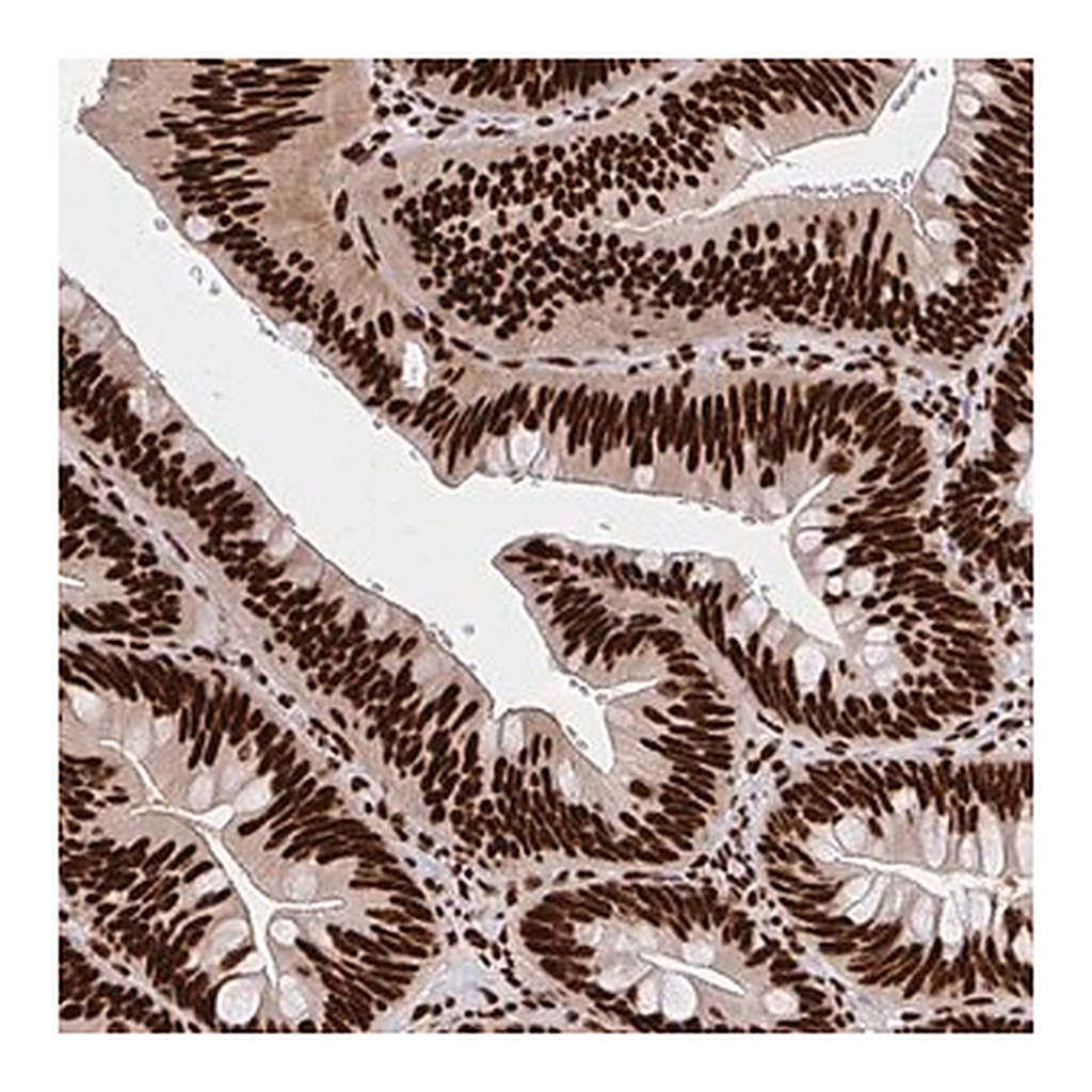 Merck Anti-CNKSR3 antibody produced in rabbit