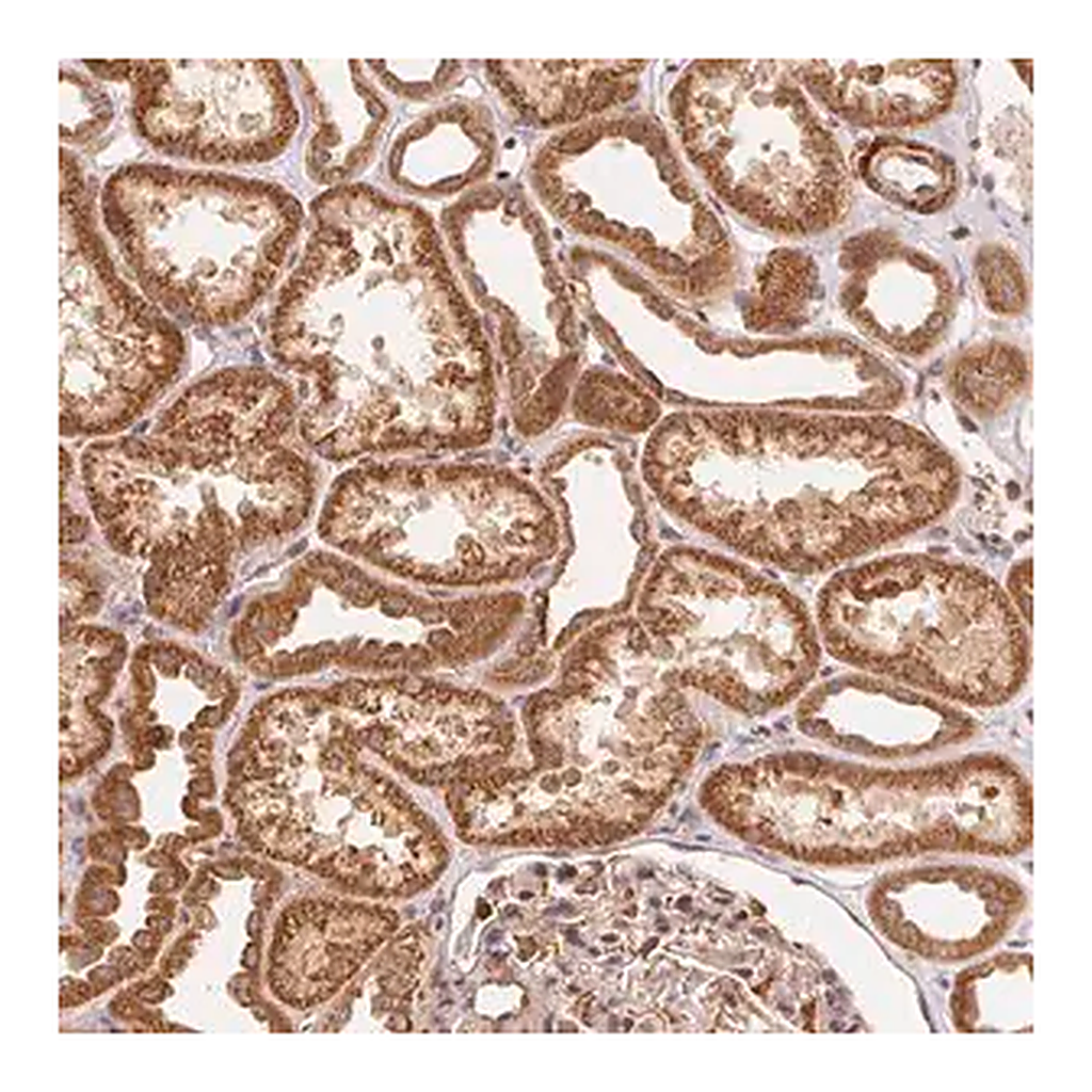 Merck Anti-TNIP2 antibody produced in rabbit