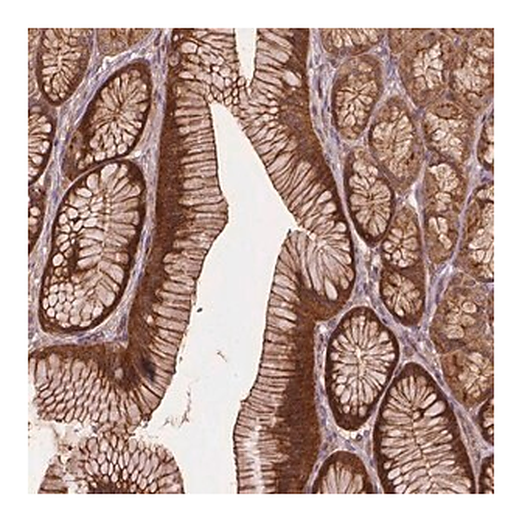 Merck Anti-ZMYND19 antibody produced in rabbit