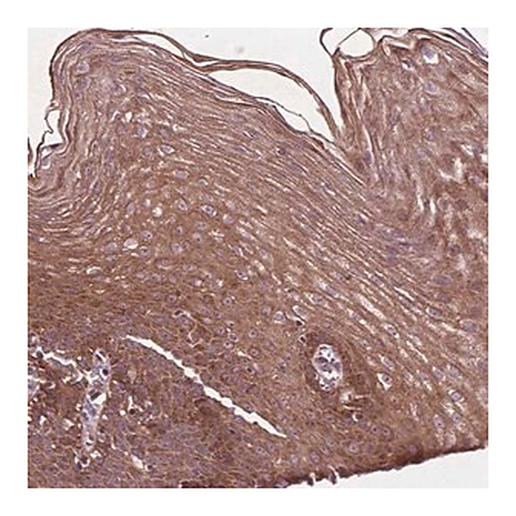 Merck Anti-B3GALNT2 antibody produced in rabbit