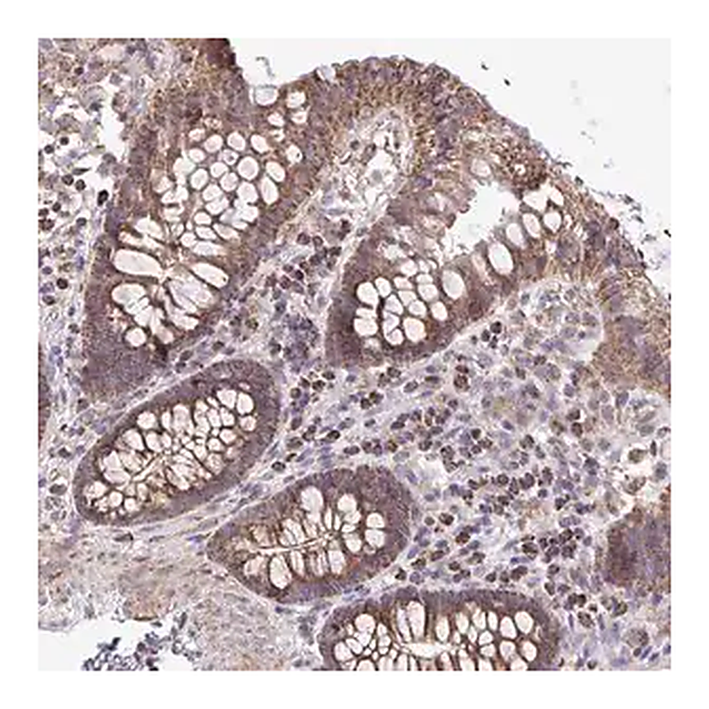 Merck Anti-ATP13A2 antibody produced in rabbit