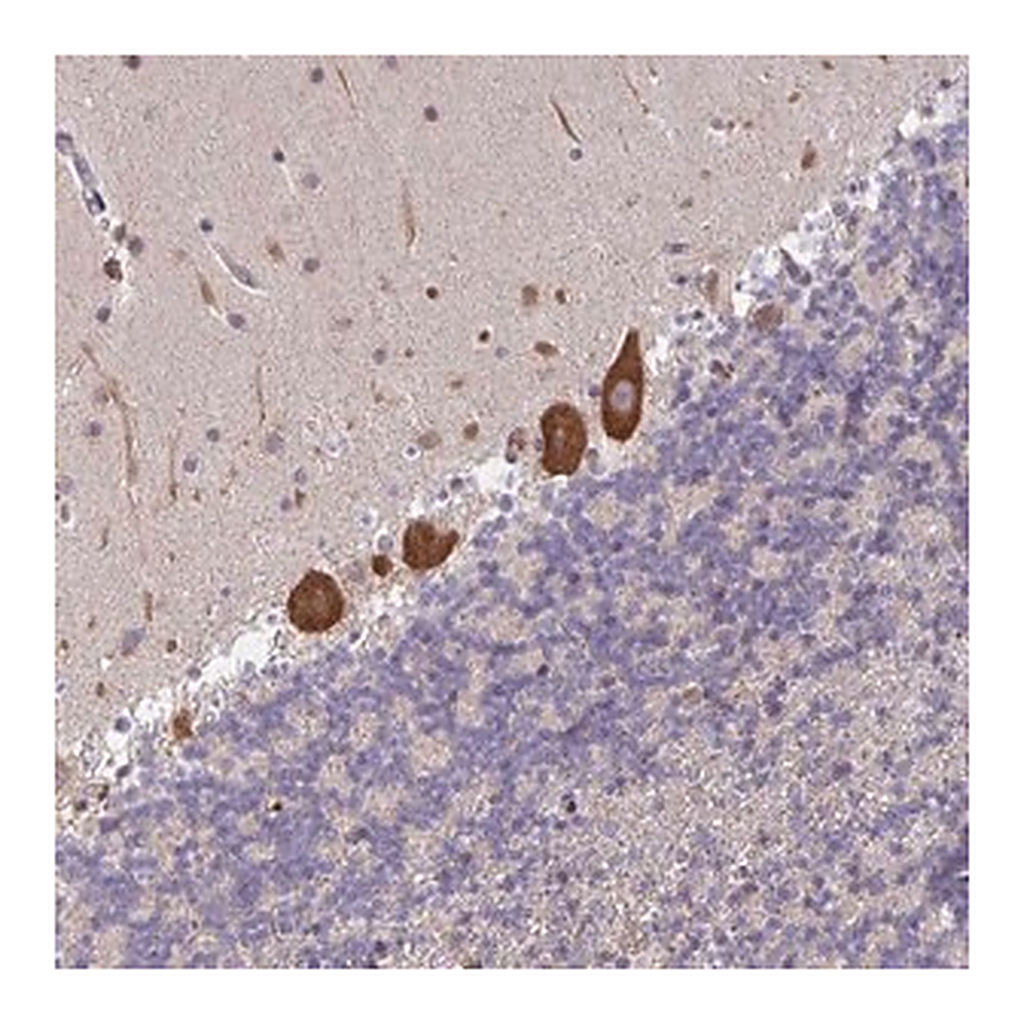 Merck Anti-LARP1 antibody produced in rabbit