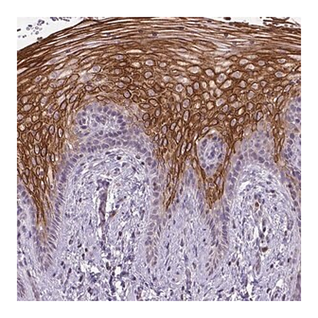 Merck Anti-NUDT3 antibody produced in rabbit