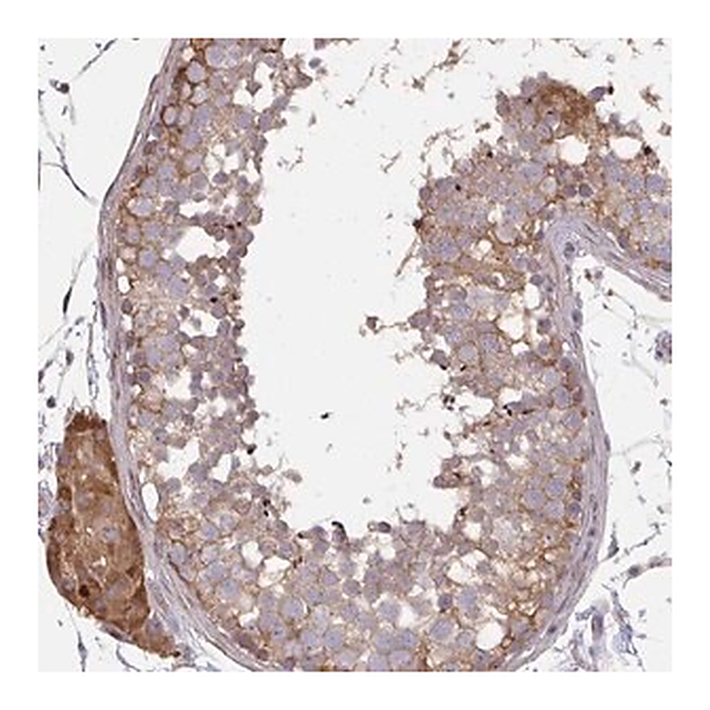 Merck Anti-ZFYVE28 antibody produced in rabbit | 캐시바이